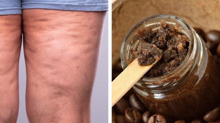 This simple coffee scrub transforms your skin, banishing cellulite and stretch marks…