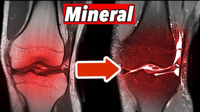 7 Ways This Essential Mineral Can Save Your Knee Health Today!