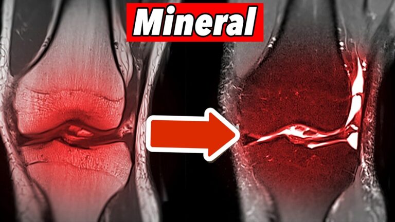 Discover 7 Essential Minerals for Protecting Knee Cartilage You Can’t Ignore!