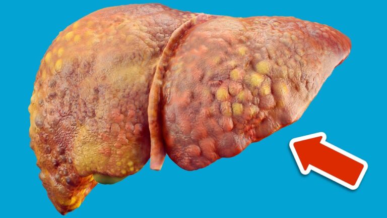 10 Common Foods Hurting Your Liver That You Eat Every Day!