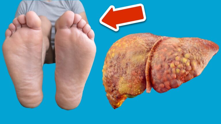 7 Surprising Signs Your Skin and Feet Reveal About Liver Health