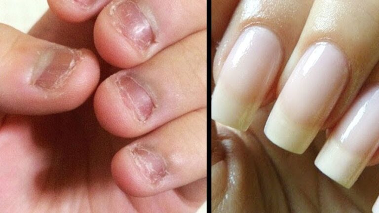 Get Gorgeous Nails in Just 7 Days with These Simple Tips!