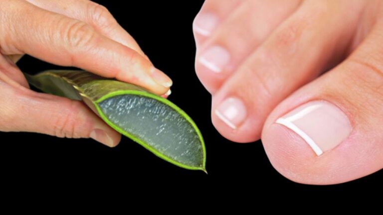 Eliminate Nail Fungus in 3 Simple Steps with Aloe’s Amazing Benefits! 🌿✨