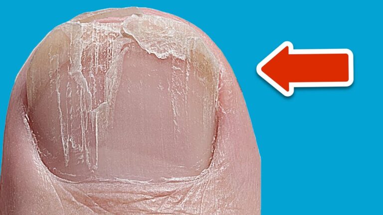 Discover 7 Shocking Truths Your Nails Reveal About Your Health!
