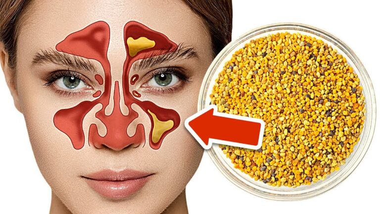10 Natural Remedies for Sinus Infections You Need to Try Now!